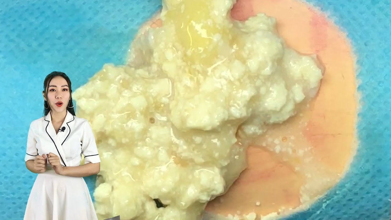 DIY Massage Cream for Spotless ,Smooth,Tight and Loss Treatments