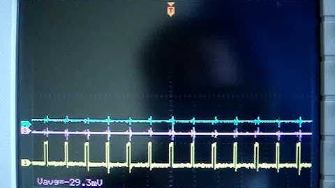 sigma-delta ADC output tracking