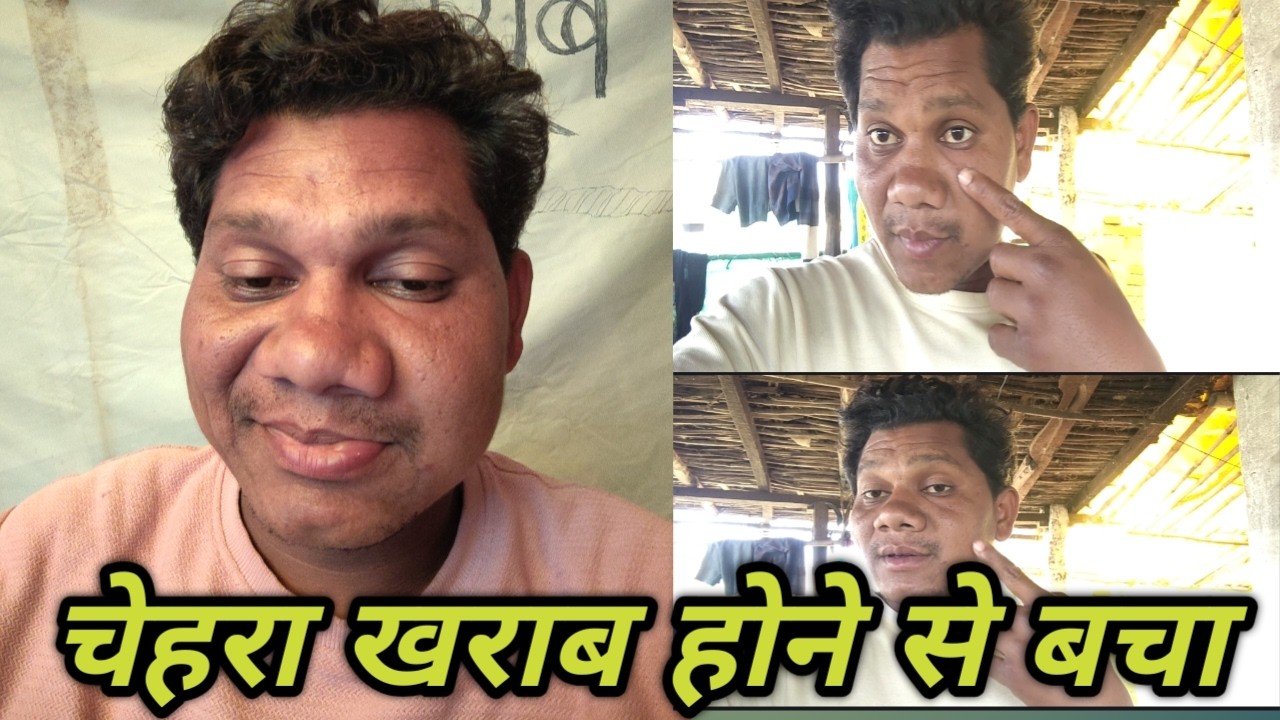 बाल-बाल बचा चेहरा खराब होने से।।