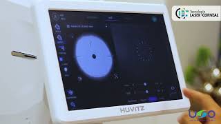 #tlcarg - Tomógrafo de Coherencia Óptica - Huvitz HOCT-1/1F - Modulo Angio