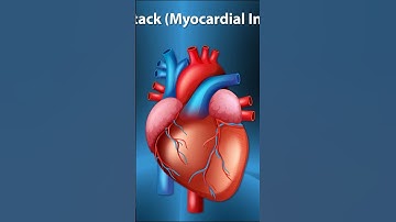 Atrial Fibrillation: America’s Silent Heart Threat You Can’t Ignore