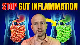 COMMENT RÉDUIRE L'INFLAMMATION INTESTINALE | Découvrez la vérité
