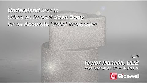 Understand How to Utilize an Implant Scan Body for an Accurate Digital Impression