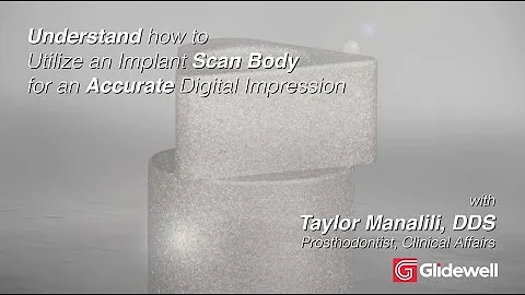 Understand How to Utilize an Implant Scan Body for an Accurate Digital Impression