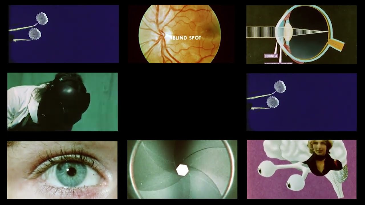 Raymond Richards - Scleral Buckle (Official)