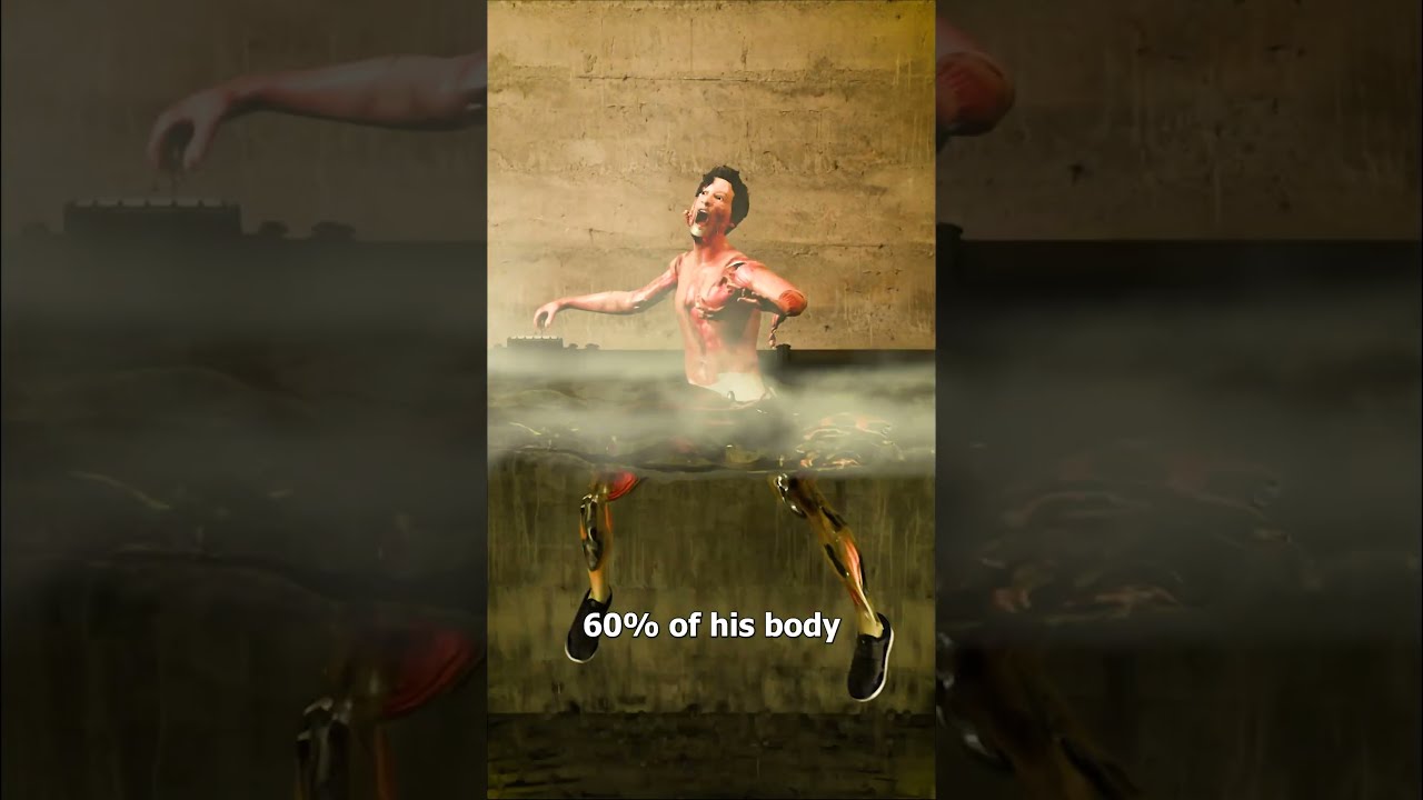 He Fell Into Boiling Water 