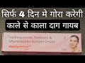 4 Dino Me Chehre ko Gora banane ke sath | kale se kala dag hataye | vaidyaglow hydroquinone cream 😍