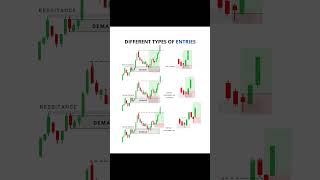 Different Types of Entries | Smart Money Concept Trading Explained 💰📈