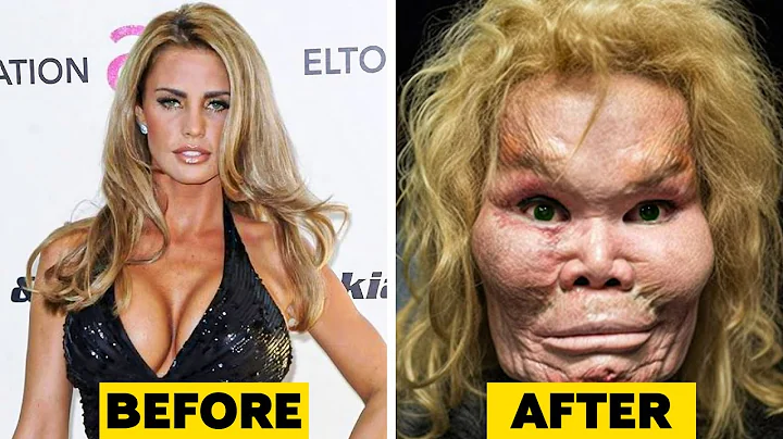 20 Celebrity Plastic Surgery Disasters - DayDayNews