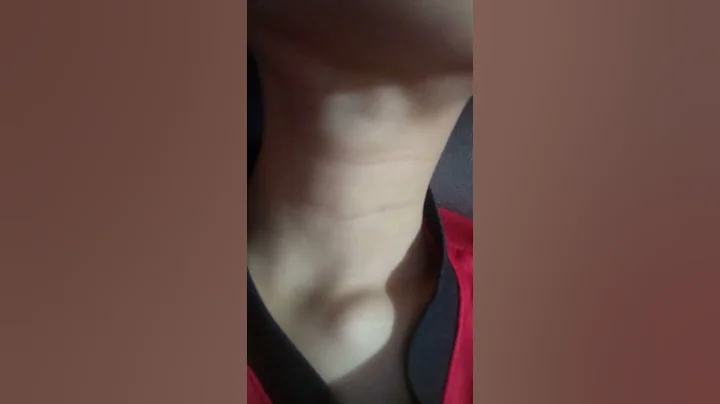 Adam's apple 2
