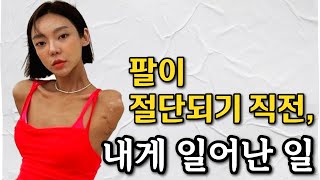 하루아침에 팔이 절단된 이유와 그녀의 팔을 찾아온 친구의 한마디