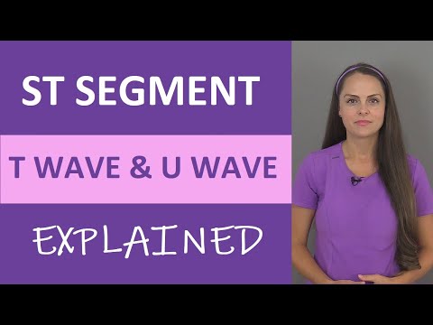 Pulsenotes  ST segment and T waves