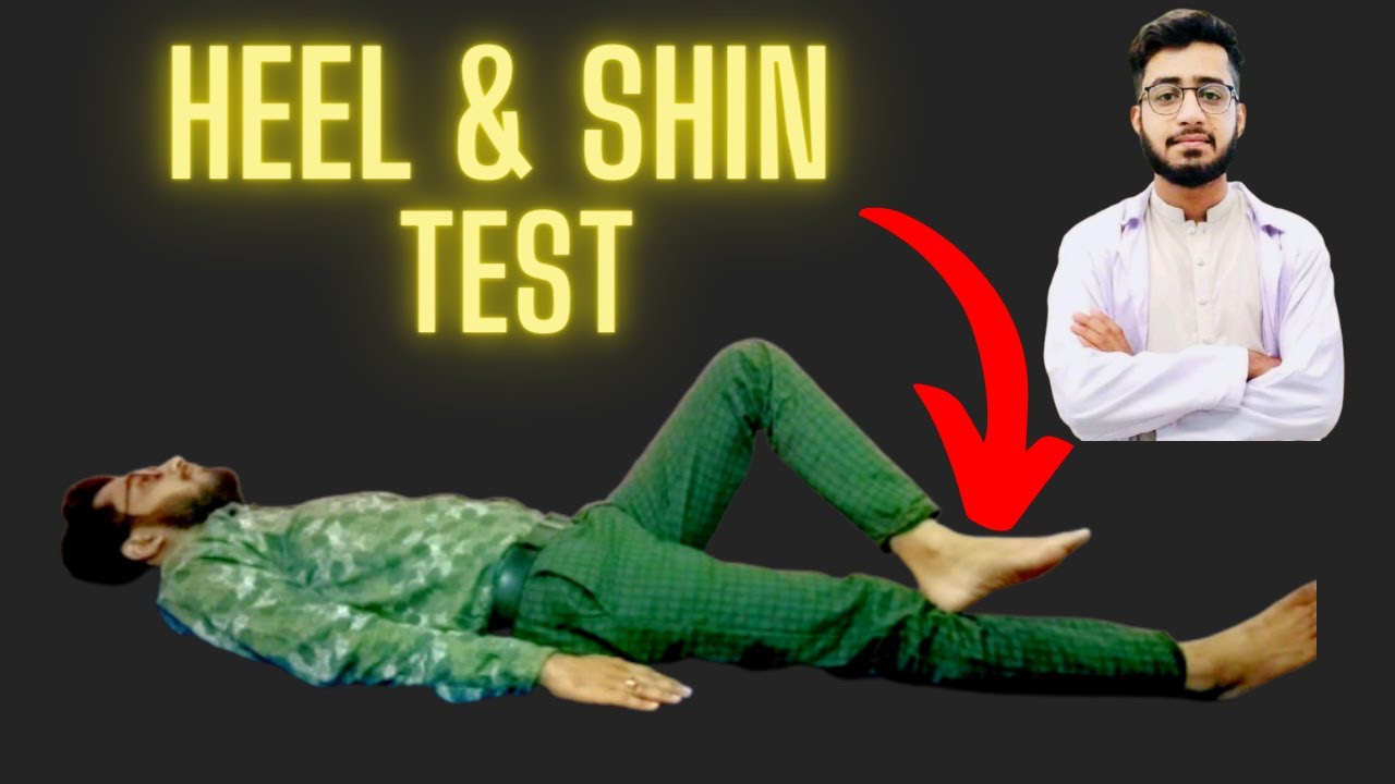 Heel-to-Shin test - YouTube