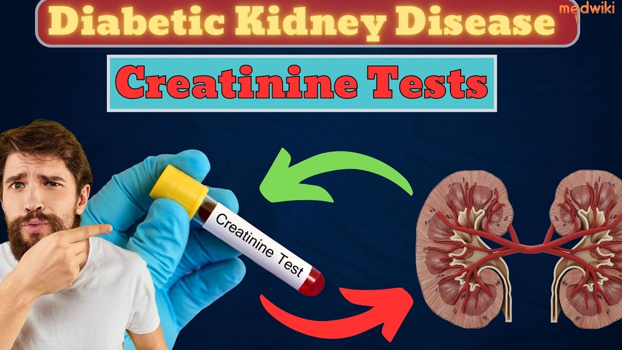 Creatinine Tests Catch Diabetic by Kidney Disease. YouTube
