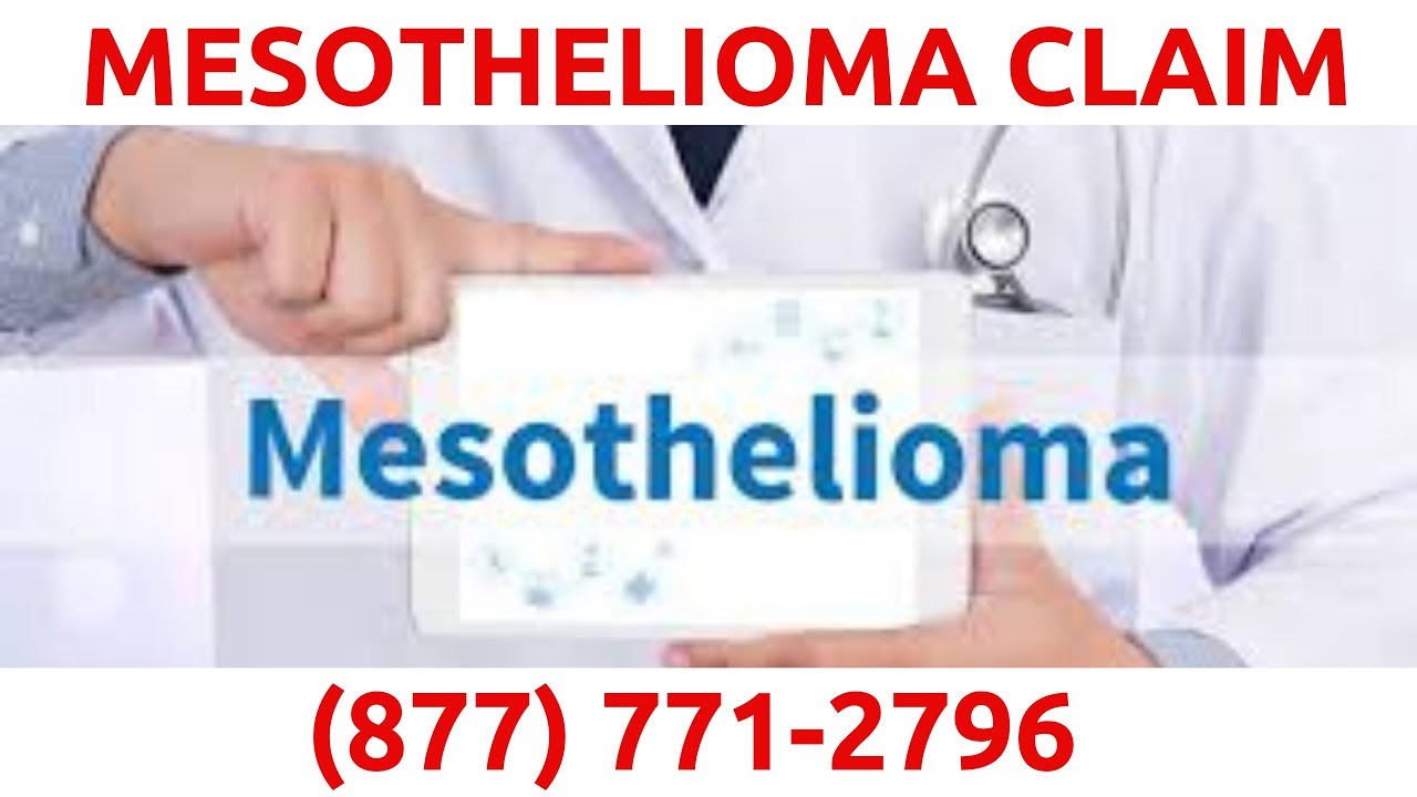 Artistic Thousand Oaks Mesothelioma, Capture Digital Art Artistic Thousand Oaks Mesothelioma, Capture Digital Art