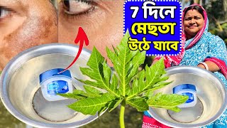 7 দন মছতর কল দগ উঠ যব Melasma Treatment