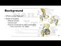 Trauma citation classics 07  hip fractures