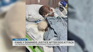 Family demands justice after dog attack