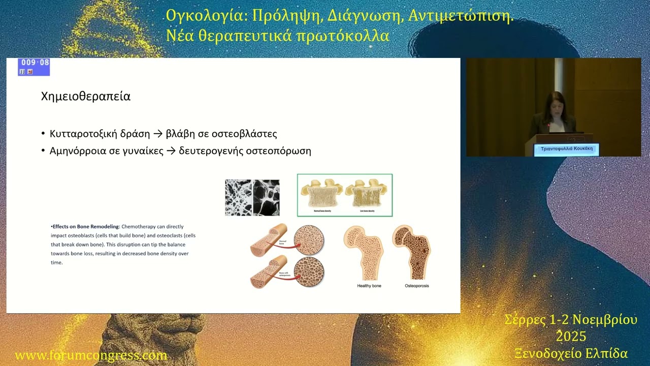Οστεοπόρωση και Αντινεοπλασματικές θεραπείες Τριανταφυλλιά  Koυκάκη