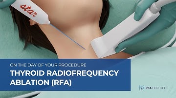 Thyroid Radiofrequency Ablation (RFA) - On the Day of your Procedure