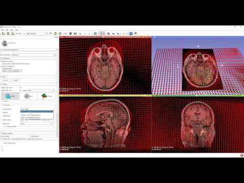 Visualizing point displacements using 3D Slicer