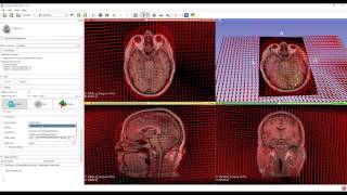 Visualizing point displacements using 3D Slicer screenshot 1