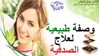 وصفة طبيعية لعلاج الصدفية screenshot 5