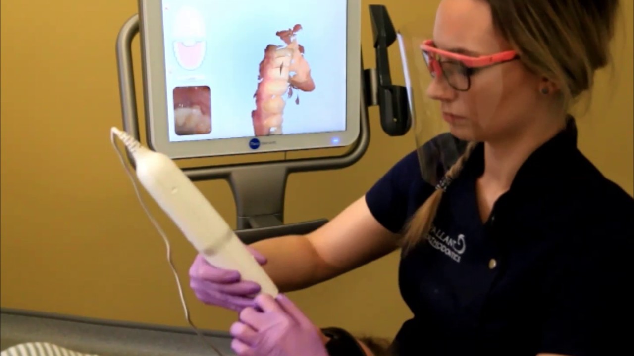 Pallant Orthodontics digital scanner demonstration - YouTube