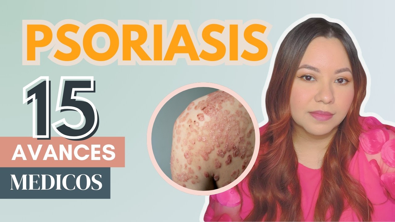 ¿El fin de la Psoriasis? 15 Nuevos Tratamientos que parecen Magia