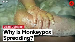 Fourth Case Of Monkeypox In India: Why is Monkeypox Spreading?