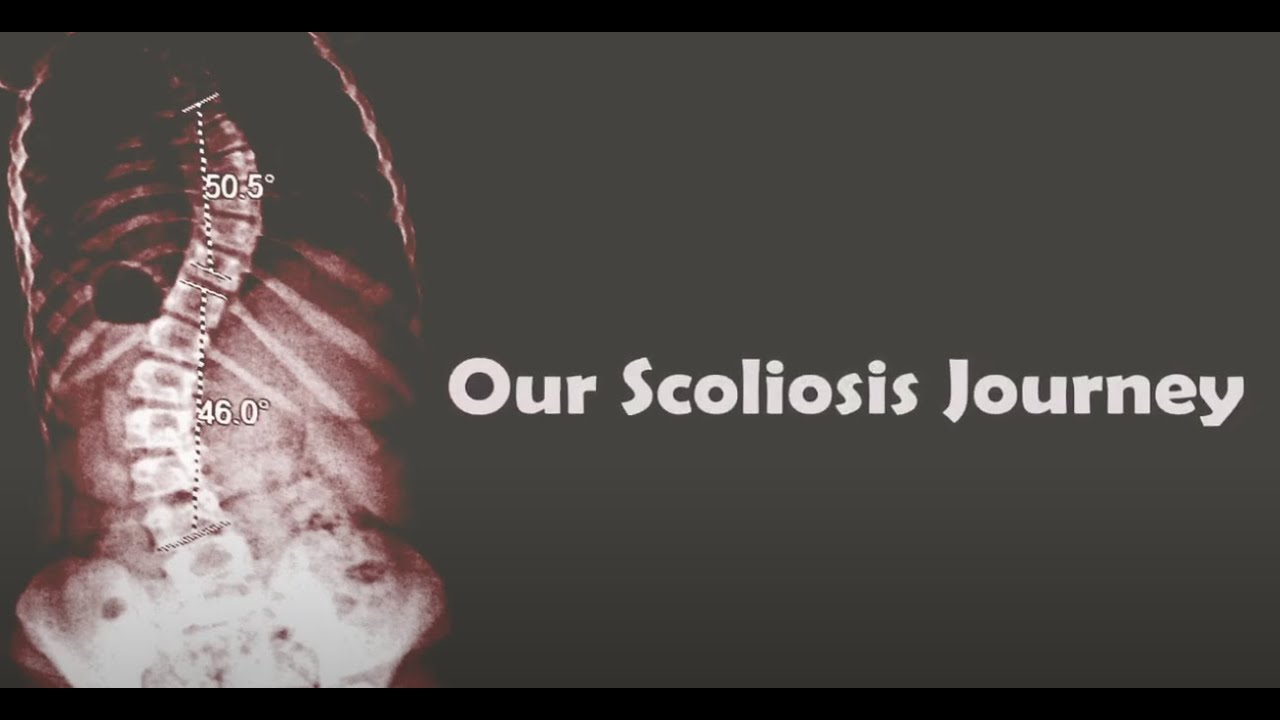 Our Scoliosis Journey