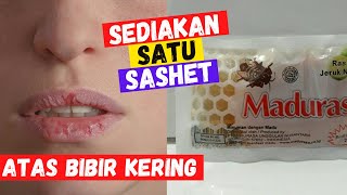 Cukup sediakan 1 Sashet Madu : Cara Mengatasi bibir kering dan hitam secara alami