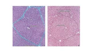 Histología del Hígado, Vesícula Biliar y Páncreas