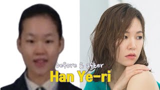 Han Ye-Ri Before And After