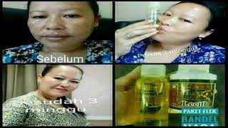 0852 3367 4981 Cara atasi Flek Hitam di wajah Paket hilangkan flek hitam