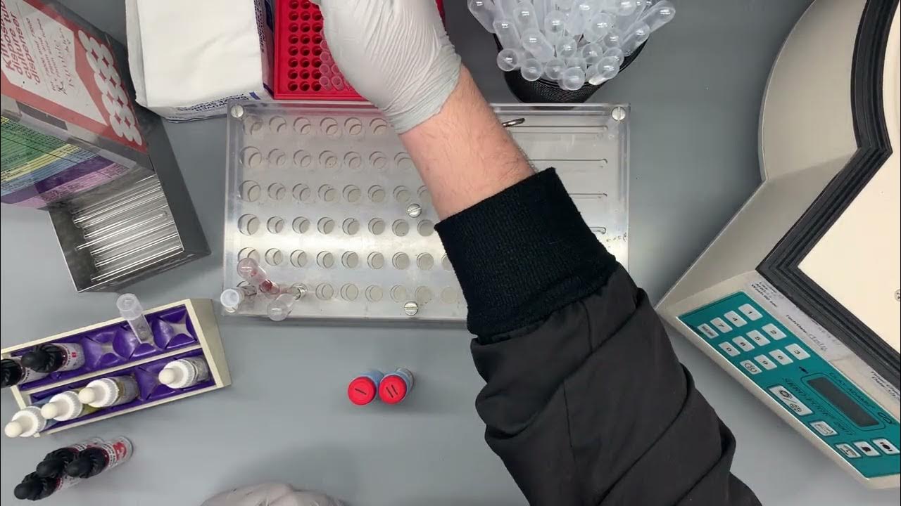 Antibody Screen Gel Procedure YouTube