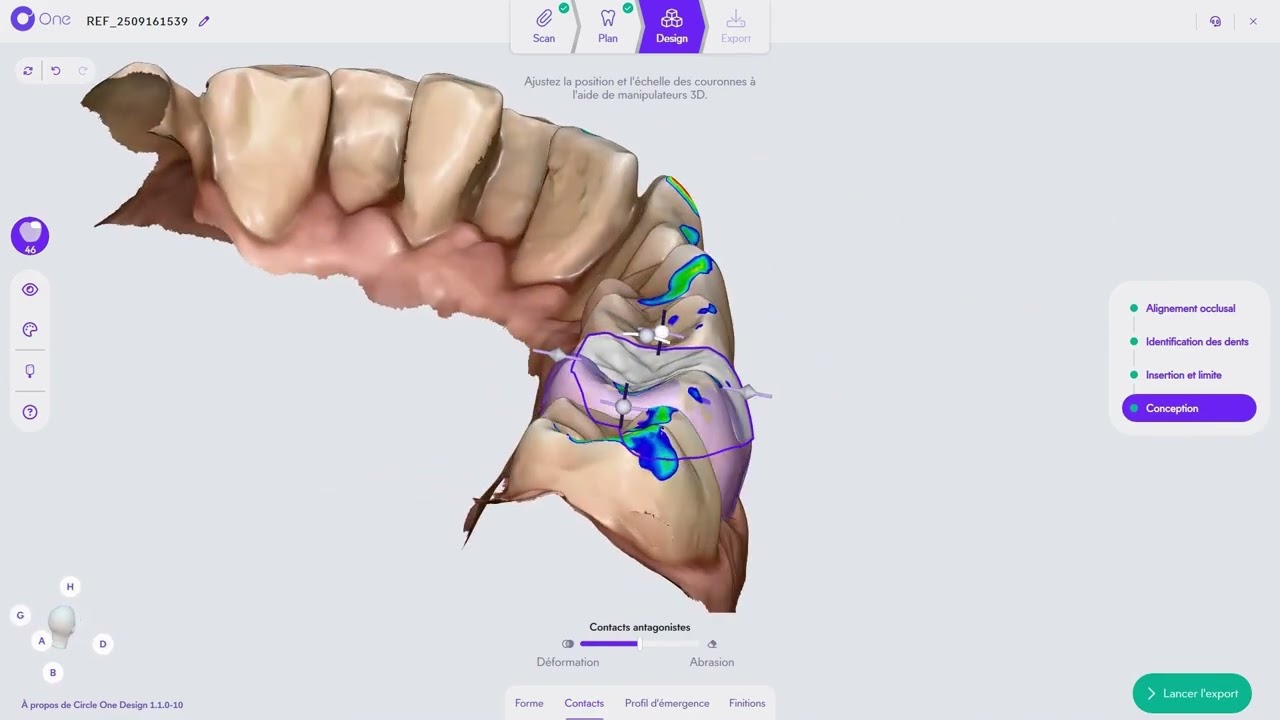 Circle One | Design Demo – Onlay