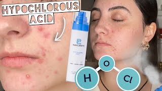 HYPOCHLOROUS ACID Sensitive Skin Ingredient for Acne & Wound Healing PurClarity Revitalizing Mist