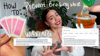 HOW TO PREVENT BRUISING WHILE WAXING | FREE PROFESSIONAL TIPS!🍯🌟🆓