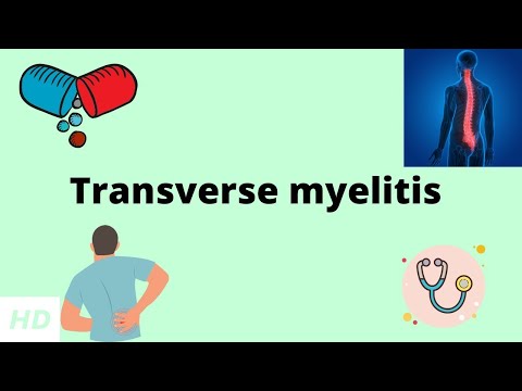 ट्रांसवर्स मायलाइटिस, कारण, संकेत और लक्षण, निदान और उपचार।