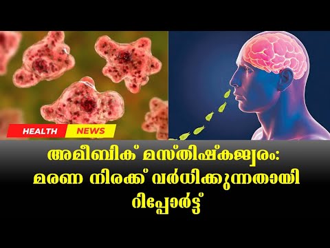 അമീബിക് മസ്തിഷ്കജ്വരം: മരണ നിരക്ക്‌ വർധിക്കുന്നതായി റിപ്പോർട്ട് |Doctor Live News #AmoebicMeningitis