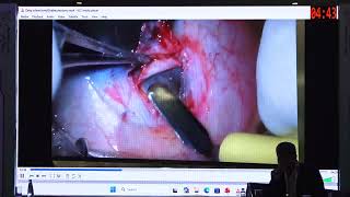 AIOC 2026 - IC224 - Combined Deep sclerectomy -Trabeculotomy for prim.. - Sadiq Mohammed Abdullahi