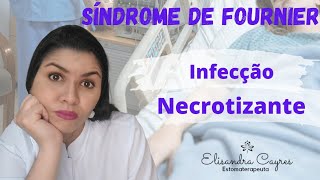 Síndrome De Fournier - O Que É, Causas E Tratamento Na Estomaterapia.