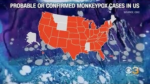 WHO Declares Monkeypox A Public Health Emergency Of International Concern