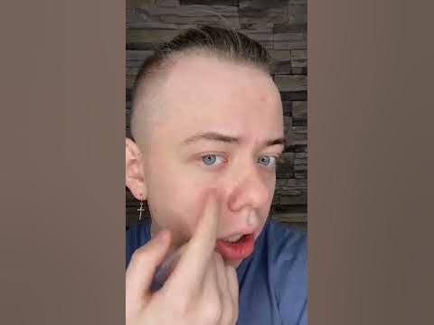ПЛАСТЫРИ ВЫТЯГИВАЮЩИЕ ПРЫЩИ 🤯 #shorts - YouTube