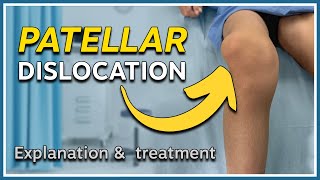 Patellar dislocation explained & how it can be treated