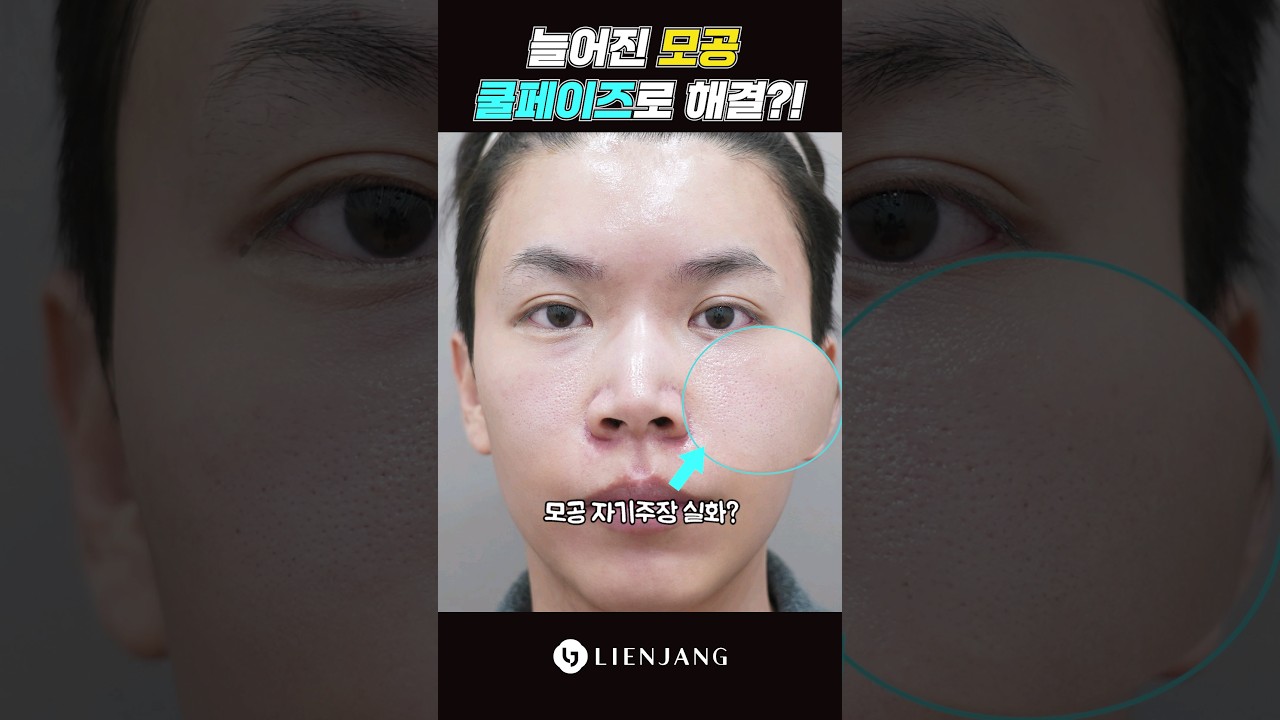 [Лиенжан гоо сайхны мэс заслын эмнэлэг] Күүл Фазе #shorts