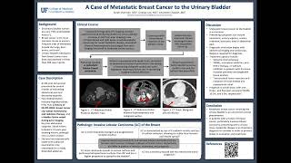 FL ACP POSTER 2023 - A Case of Metastatic Breast Cancer to the Urinary Bladder
