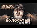 Самые волосатые люди: гипертрихоз | Хочу спросить