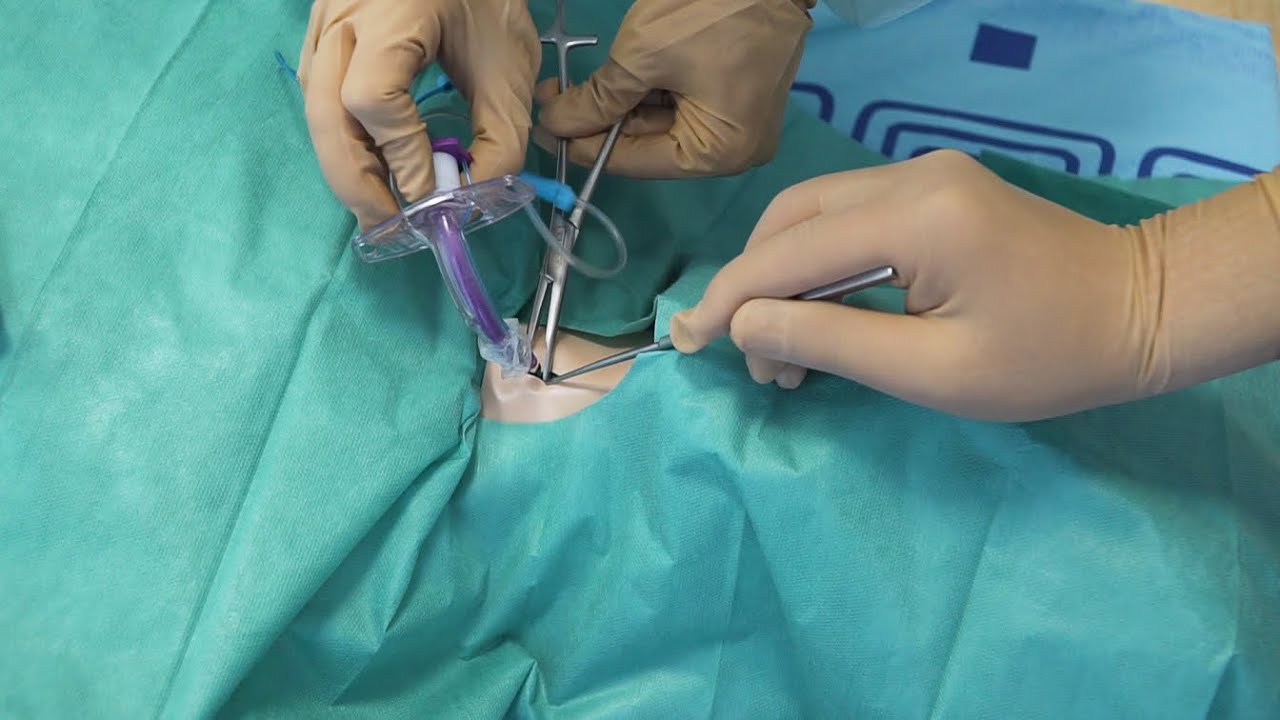 Хирургическая коникотомия с расширителем Труссо - YouTube